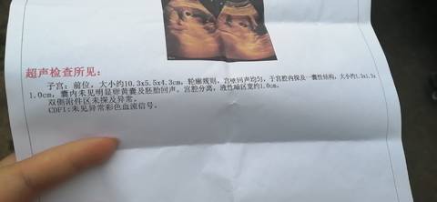 journal_insert_pic_1682626020