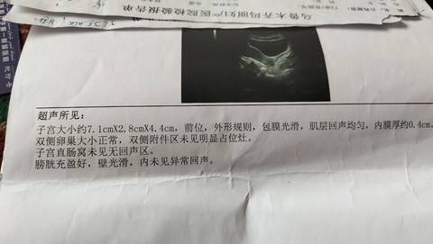 journal_insert_pic_1685858914