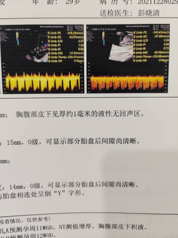 journal_insert_pic_1687799930