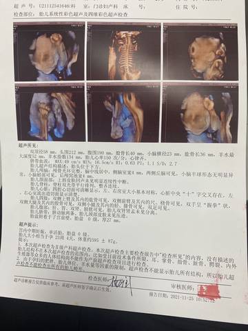 journal_insert_pic_1687260041