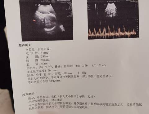 journal_insert_pic_1682382363