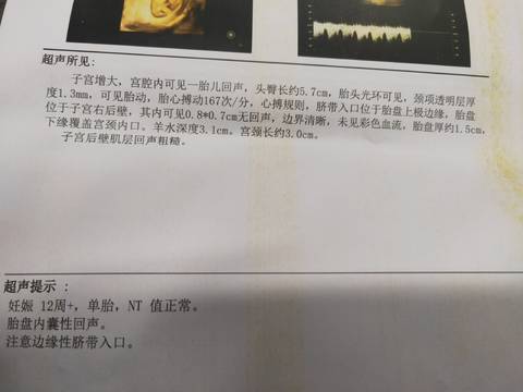 journal_insert_pic_1686934532