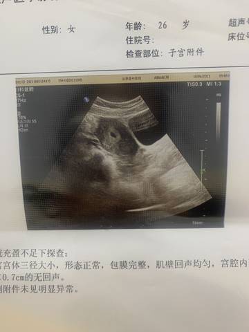 journal_insert_pic_1673072228