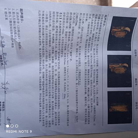 journal_insert_pic_1740859654