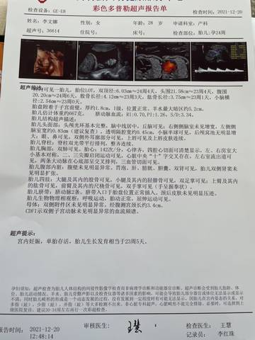 journal_insert_pic_1683111365