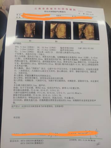 journal_insert_pic_1674386902