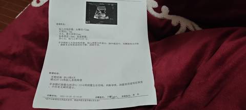 journal_insert_pic_1683422797