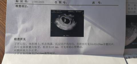 journal_insert_pic_1674898642