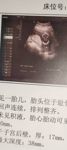 journal_insert_pic_1689645046