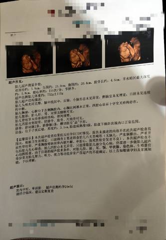 journal_insert_pic_1683919828