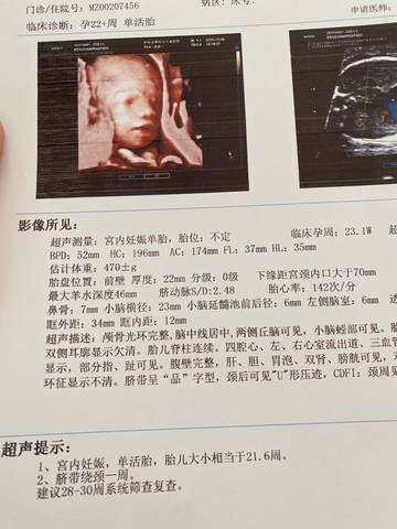 journal_insert_pic_1673988340