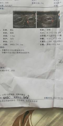 journal_insert_pic_1684970344
