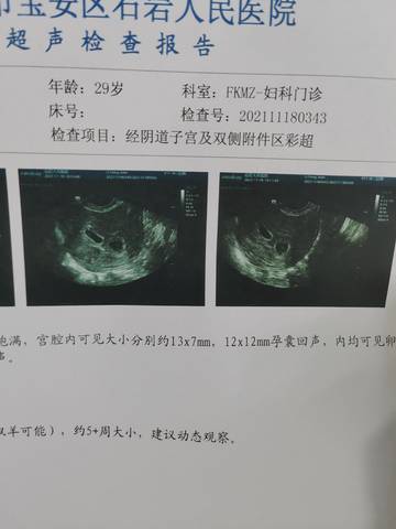 journal_insert_pic_1677325836