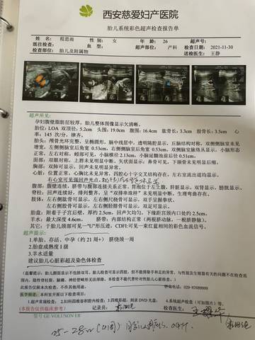 journal_insert_pic_1677456162
