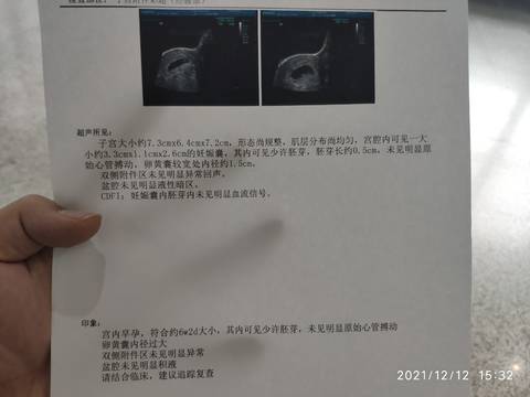 journal_insert_pic_1678503121