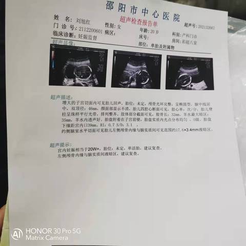 journal_insert_pic_1683777840