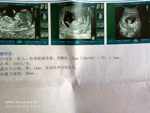 journal_insert_pic_1690118058