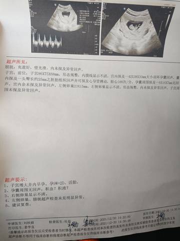 journal_insert_pic_1688957754