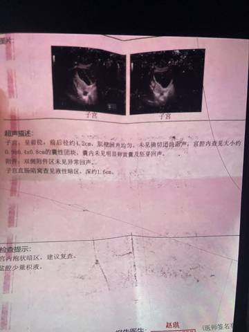 journal_insert_pic_1681582210