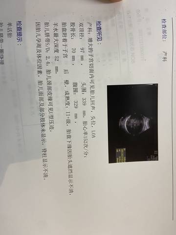 journal_insert_pic_1680135861