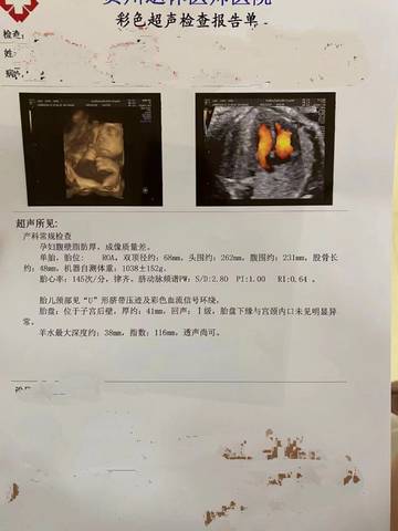 journal_insert_pic_1688553393