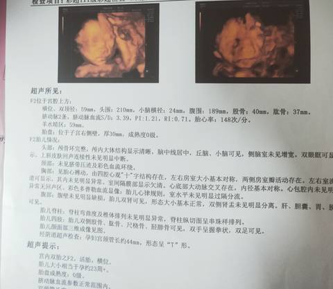 journal_insert_pic_1675084449