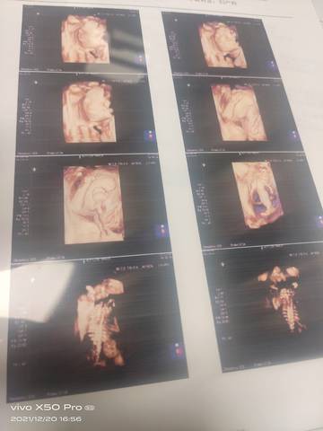 journal_insert_pic_1683156175