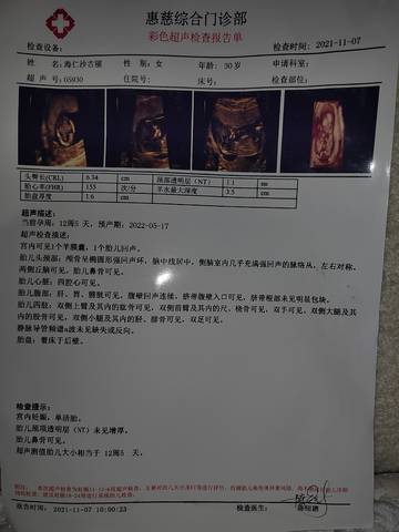 journal_insert_pic_1689168107