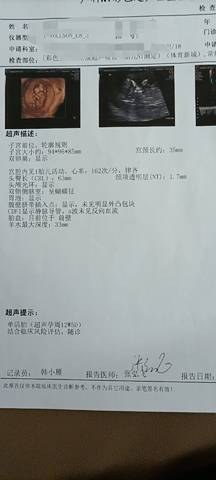 journal_insert_pic_1719411232