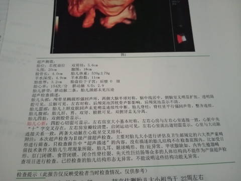 journal_insert_pic_1688421955