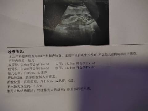 journal_insert_pic_1675782423