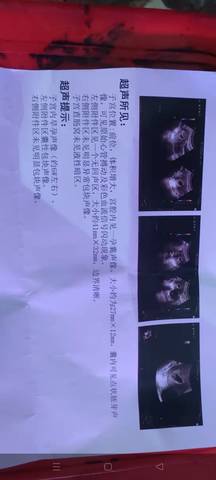 journal_insert_pic_1681042445