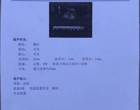 journal_insert_pic_1689476018