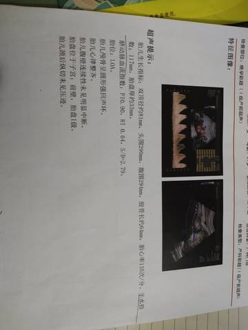 journal_insert_pic_1681138236