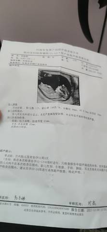 journal_insert_pic_1741030199