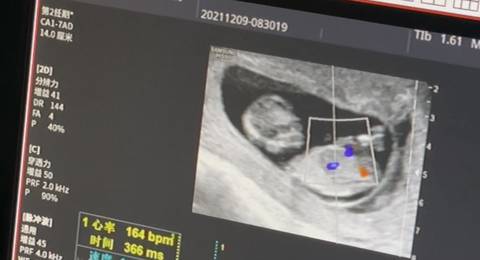 journal_insert_pic_1676707304