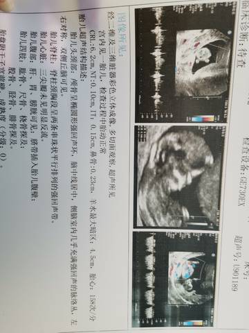 journal_insert_pic_1688231778