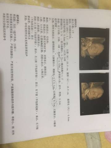 journal_insert_pic_1689192085