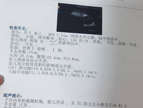 journal_insert_pic_1686106550