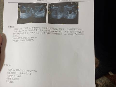 journal_insert_pic_1681618423