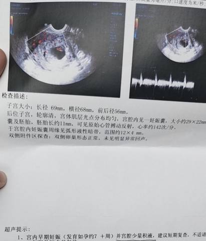 journal_insert_pic_1688319233