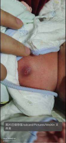 journal_insert_pic_1678003684