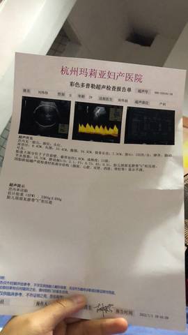 journal_insert_pic_1690022594