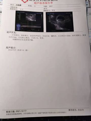 journal_insert_pic_1681550684