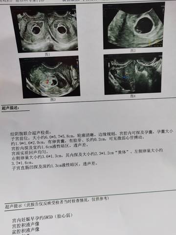 journal_insert_pic_1685333481