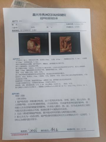 journal_insert_pic_1674599315