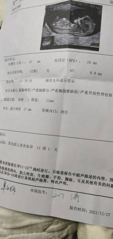 journal_insert_pic_1687241634