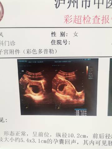 journal_insert_pic_1673509950