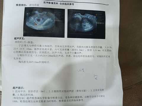 journal_insert_pic_1683769072