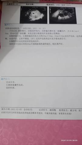 journal_insert_pic_1677099151